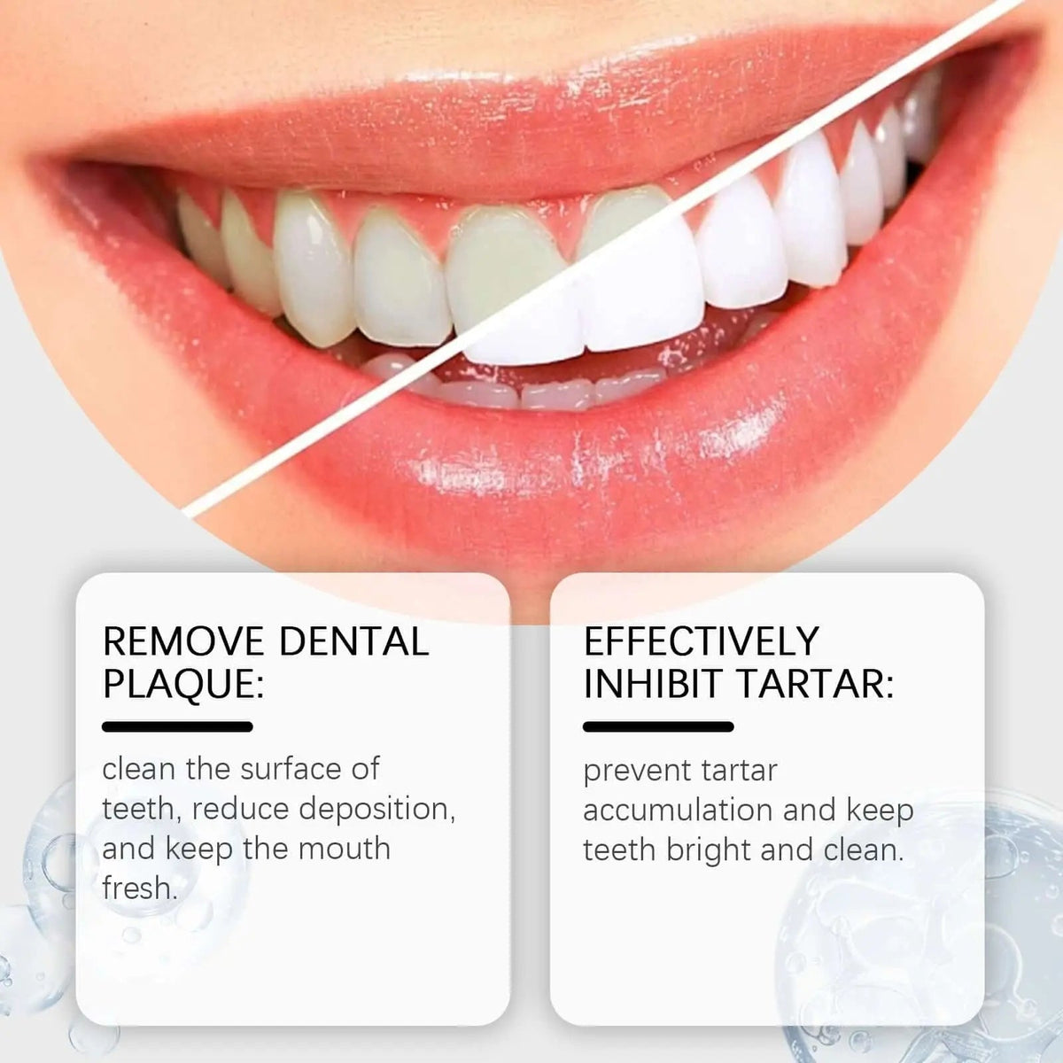Brightening Whitening Toothpaste | معجون أسنان بالنياسيناميد لتفتيح الأسنان وإزالة التصبغات
