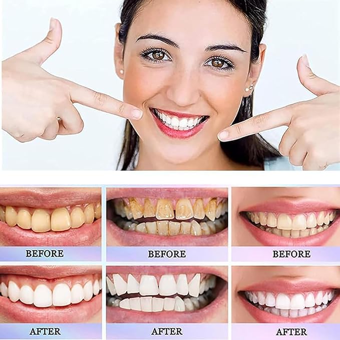 Brightening Whitening Toothpaste | معجون أسنان بالنياسيناميد لتفتيح الأسنان وإزالة التصبغات