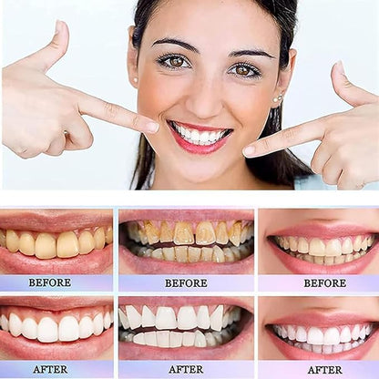 Brightening Whitening Toothpaste | معجون أسنان بالنياسيناميد لتفتيح الأسنان وإزالة التصبغات