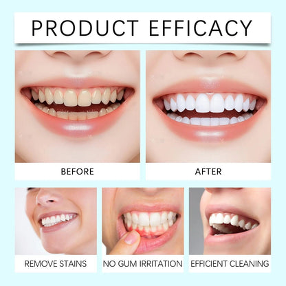 Brightening Whitening Toothpaste | معجون أسنان بالنياسيناميد لتفتيح الأسنان وإزالة التصبغات